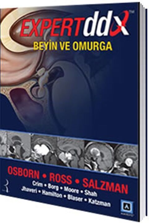 Pelikan Yayınları Expert DDX Beyin ve Omurga