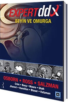 Pelikan Yayınları Expert DDX Beyin ve Omurga